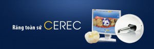 Răng toàn sứ Cerec CAD - CAM