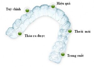 Ưu điểm niềng răng trong suốt