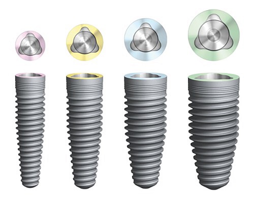 Kinh nghiệm làm răng implant từ khách hàng 3